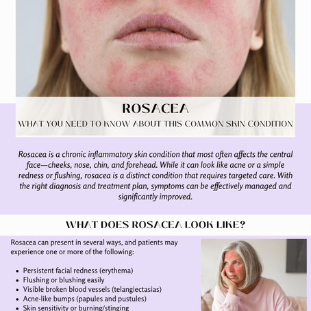 A woman with rosacea