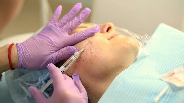 Vampire Facial in Dubai