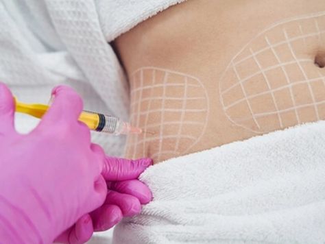 How Does Aqualyx Injection Help Reduce Stubborn Fat?