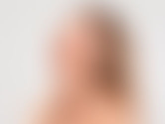 Facial Contouring in Dubai