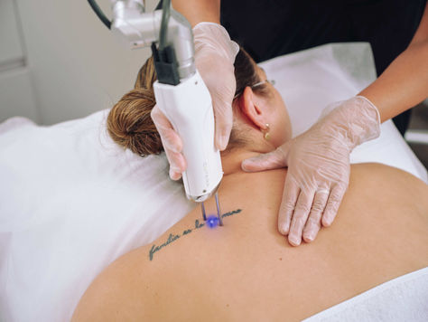 Does laser tattoo removal work on all skin types?