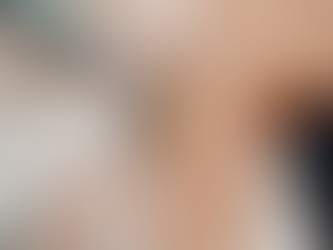 Laser Hair Removal in Dubai