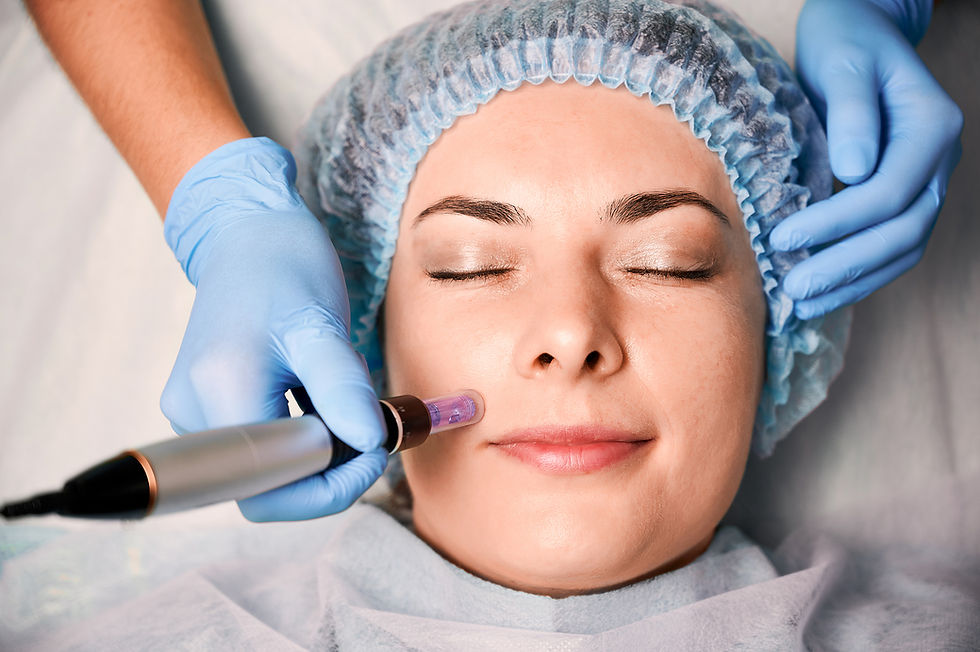 Microneedling Treatment Dubai