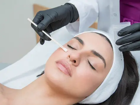 Chemical Peel Treatment in Dubai