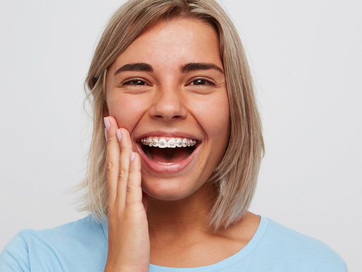 Are Invisalign Aligners Better Than Traditional Braces?