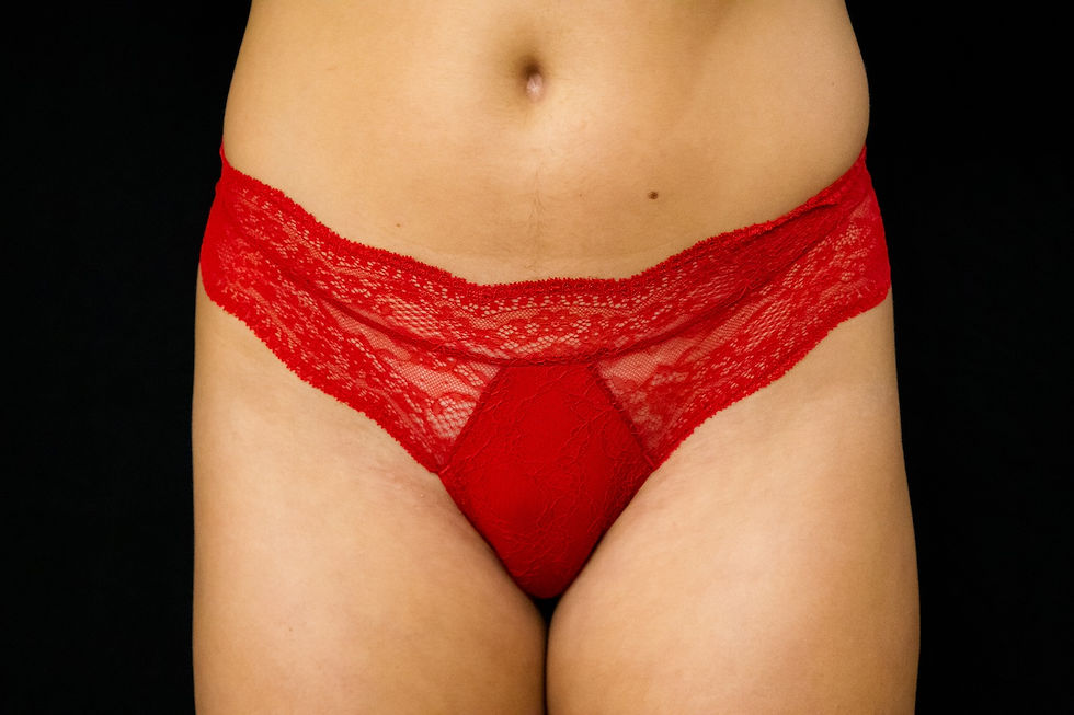 Miniature : Shorty en dentelle rouge - Motif floral