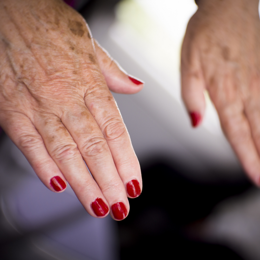 10 Must Know Facts About Lupus