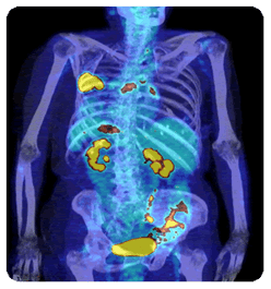 PETSCAN.gif