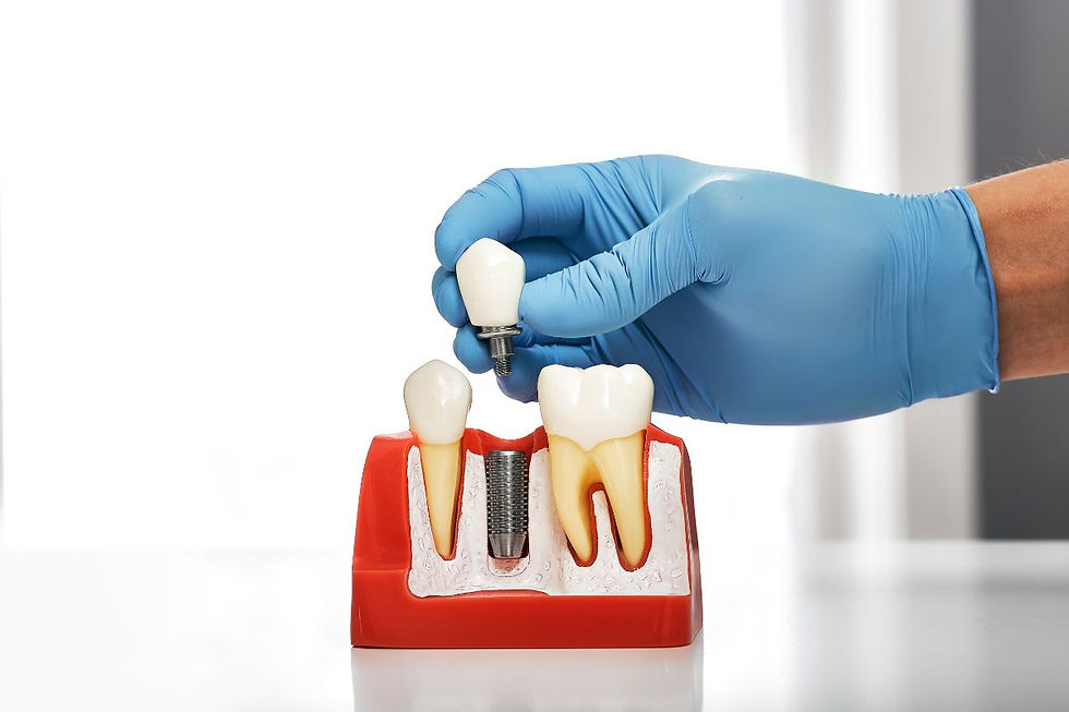 Dental Implants Chandler