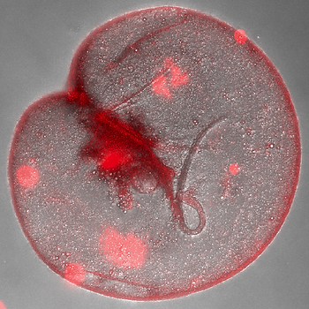 Micrograph of a phytoplankton cell
