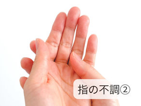 ばね指は「使いすぎ」だけとは限らないかも