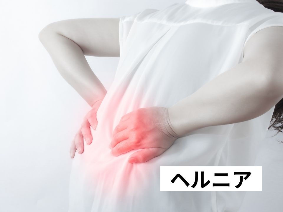 ヘルニア