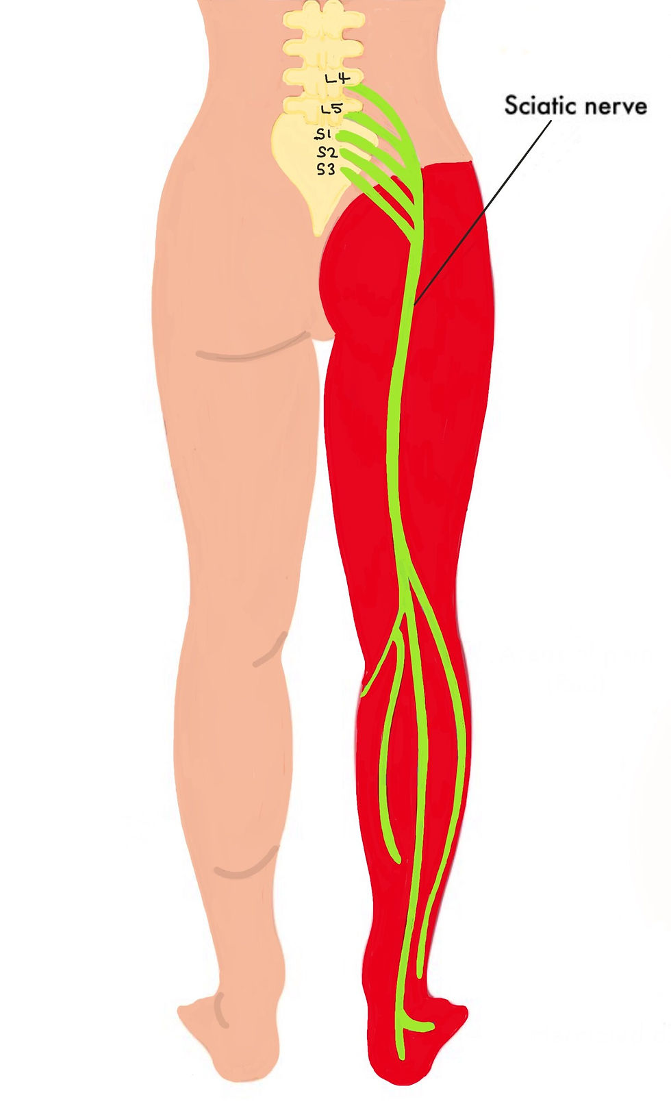 sciatic-nerve-lumbar-disc-scaled.jpg