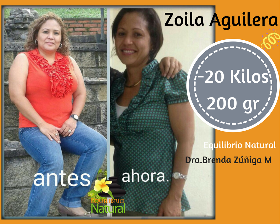 ZOILA