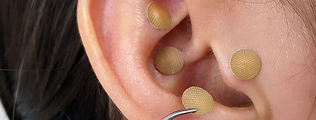 servicio-auriculoterapia-obesidad-sobrep