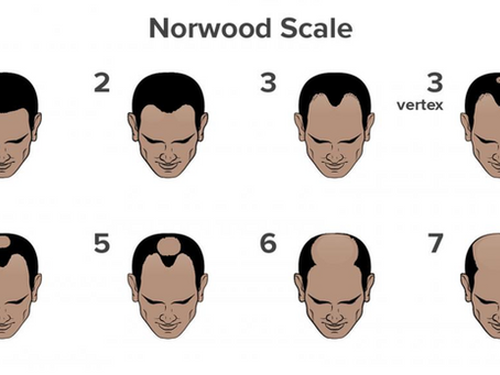What is the price of scalp micropigmentation ?