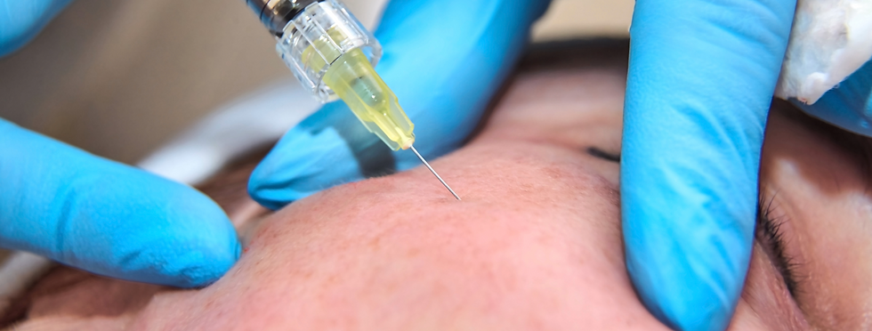 Aesthetic practitioner in Manchester administering polynucleotide injections to the face for skin regeneration, hydration, an