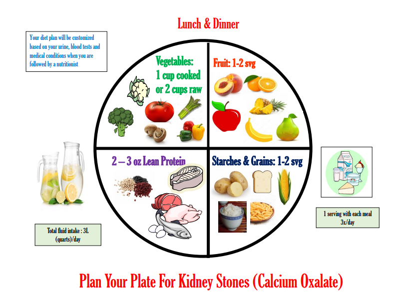 kidney Stones (calcium oxalate)