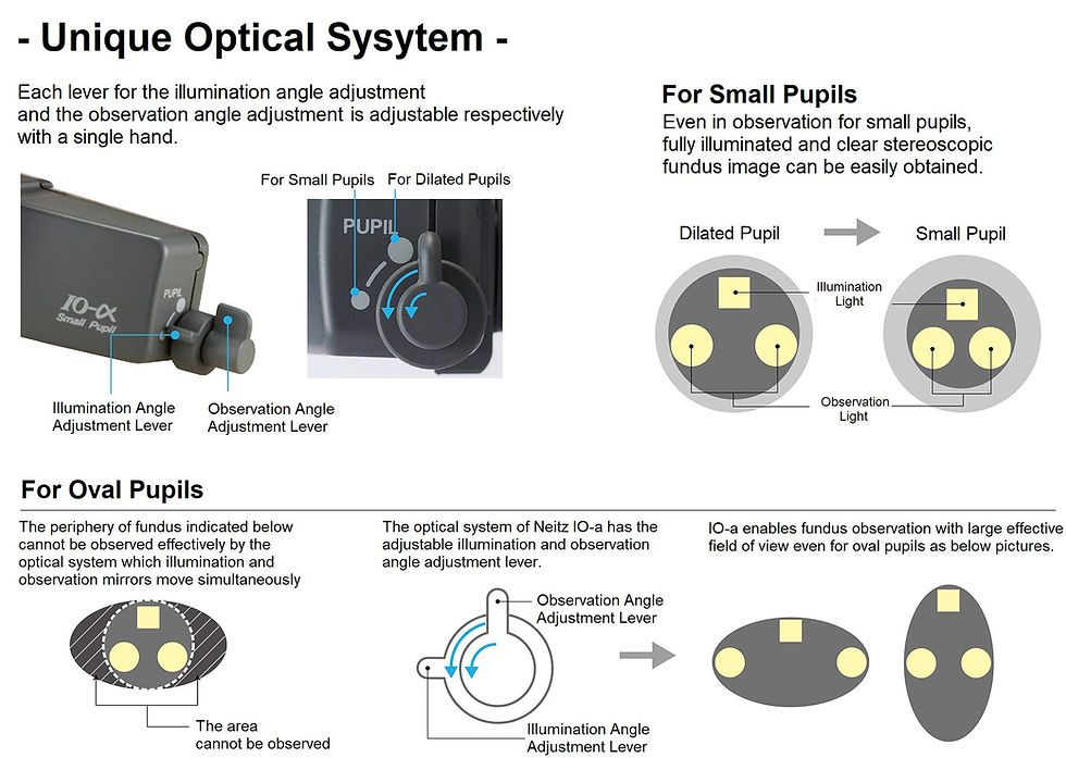 Miniatura: Oftalmoscopio binocular indirecto