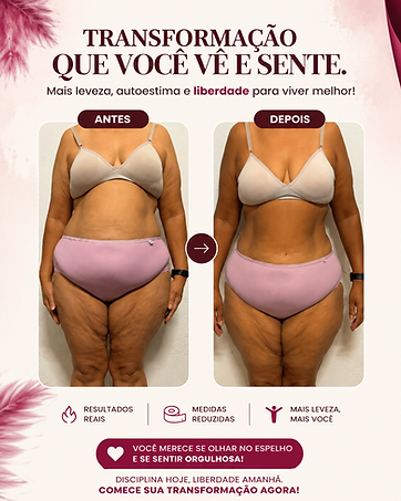 Antes e depois 01- Alada.png
