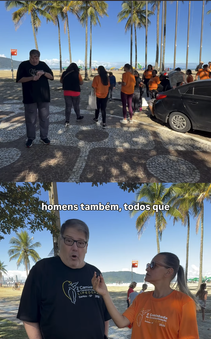 Segunta caminhada santos lipedema_