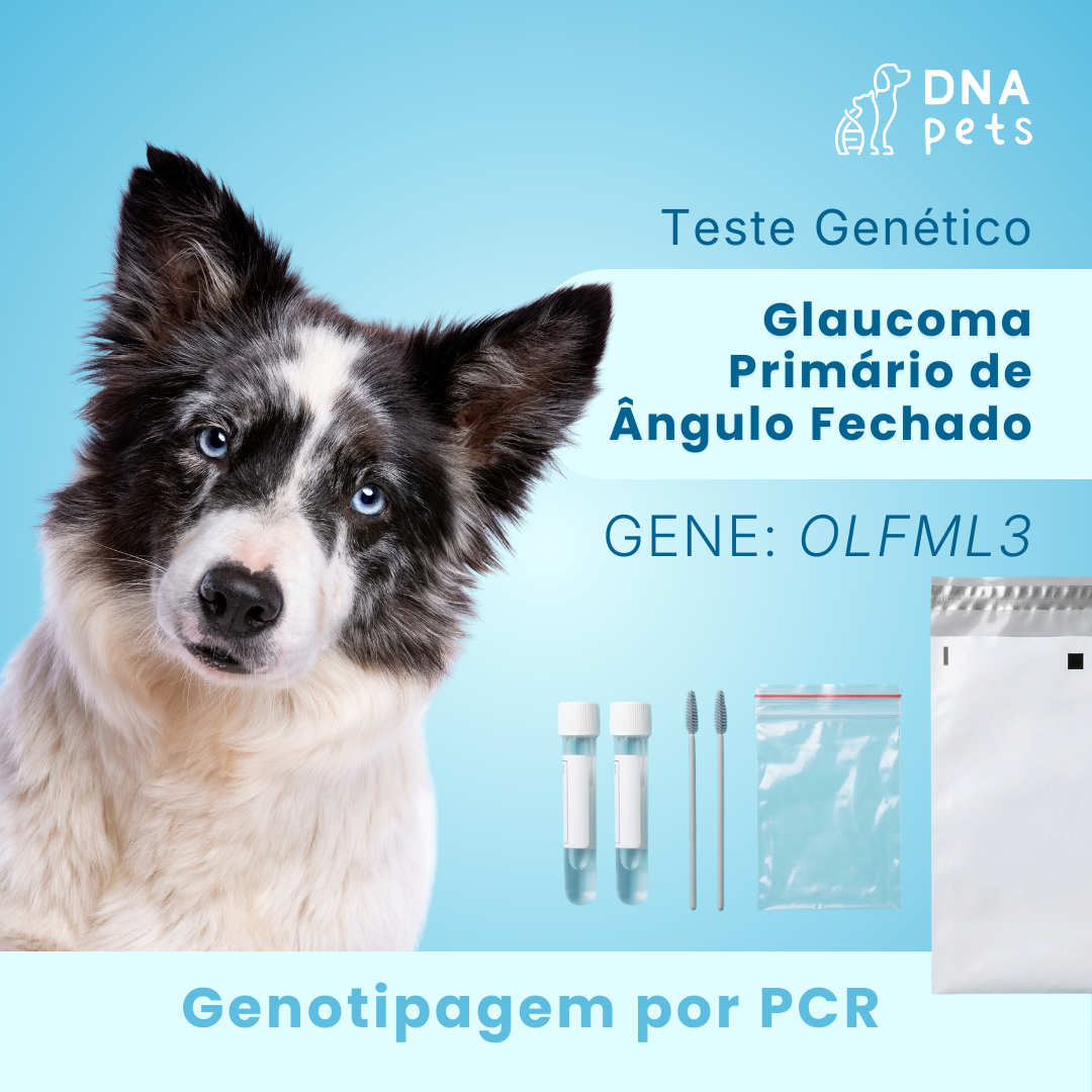 Glaucoma Primário de  Ângulo Fechado (OLFML3)