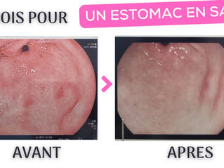Victoire sur les ulcères de mon estomac ! Retour d'expérience sur les solutions naturelles 👏🏻