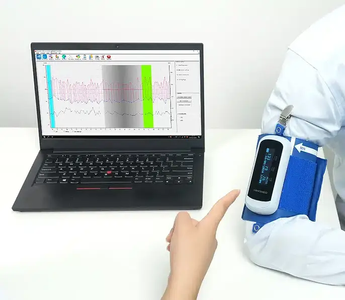 ABPM - 24 órás vérnyomás mérés