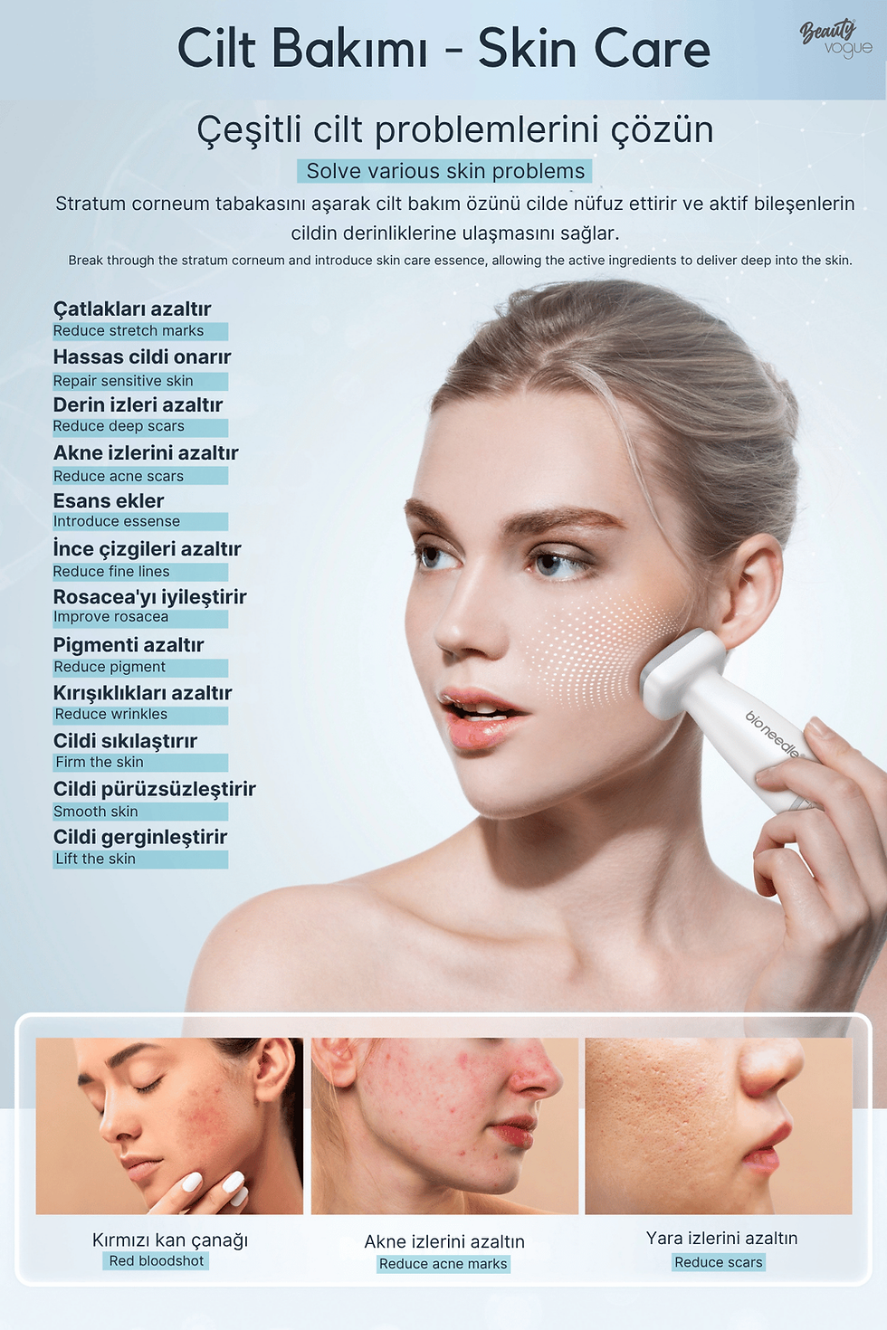 Küçük resim: Bio Needle 120 - Dermaroller Titanyum İğne