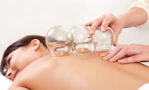Cupping Therapy (5).jpg