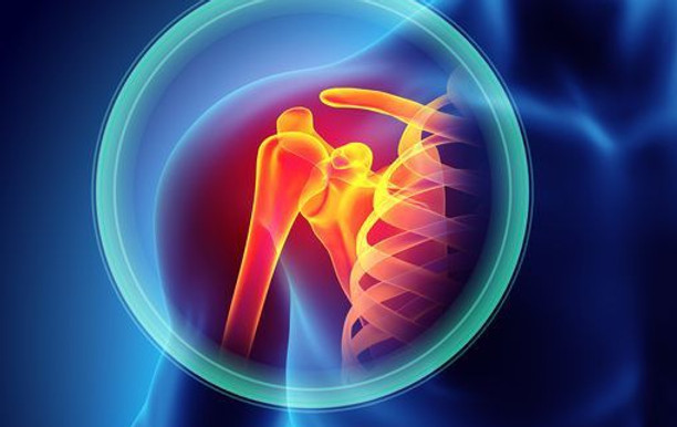 voleybsl problem.jpg