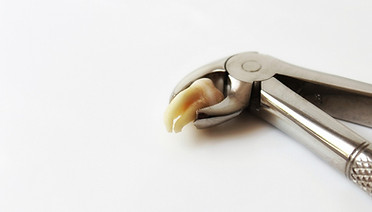 Wisdom Tooth