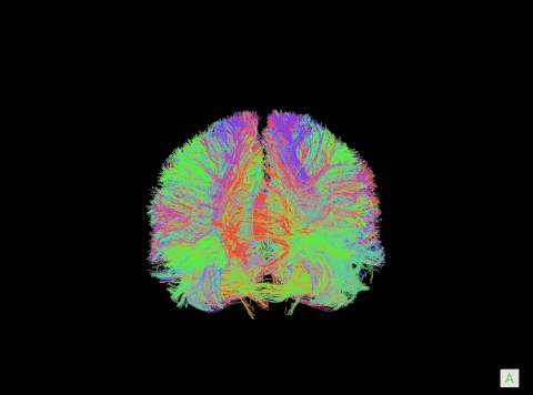 talavage-connectome (1).gif