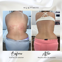 Body massage Milton Keynes