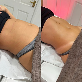 MLD Detox and Drain