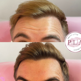 anti wrinkle clinic st helens