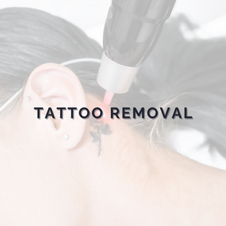 Tattoo removal