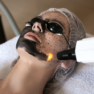 carbon laser facial Kingswinford, Dudley