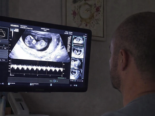 ULTRAZUK U TRUDNOĆI: KOLIKO ČESTO JE POTREBAN I DA LI JE BEZBEDAN?