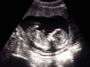 PRVI EKSPERTNI ULTRAZVUK - prvi važan korak ka upoznavanju Vaše bebe