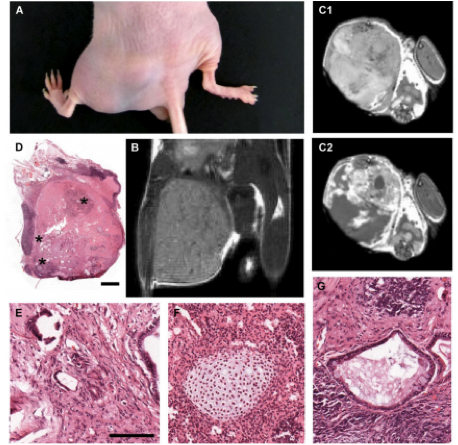 Tumorigenicity assay in nude mice ...