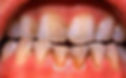 images-4.jpeg