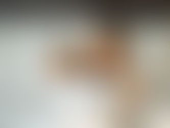 Woman lying awake in bed holding her head with a distressed expression, illustrating the frustration and discomfort of insomnia and sleep difficulties.