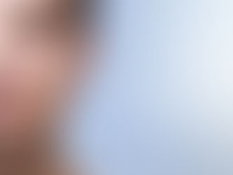 Estética Masculina: Benefícios do Preenchimento Mandibular