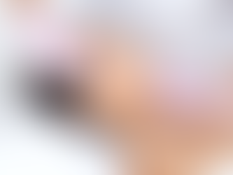 Is Getting Under Eye Fillers Worth It? Insights for Dubai Patients
