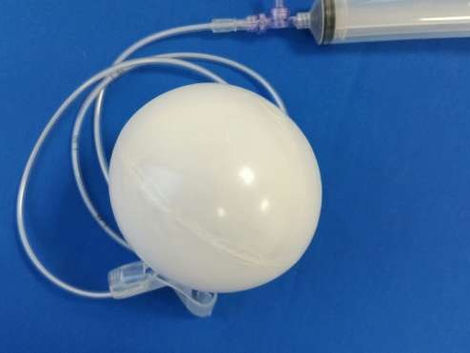 Allurion Balloon Cost Breakdown: Procedure vs. Total Treatment