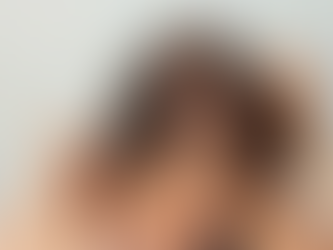 The Ultimate Guide to Hair Loss Treatment Options in Dubai