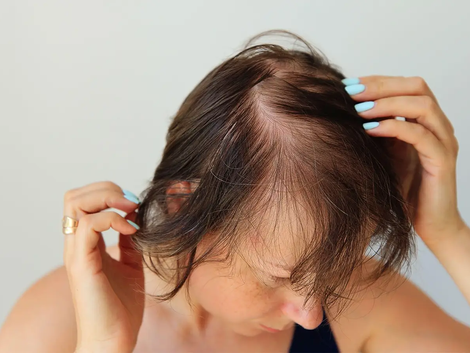 The Ultimate Guide to Hair Loss Treatment Options in Dubai
