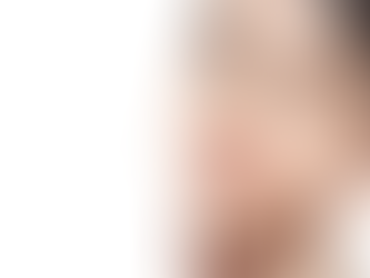 Juvederm Fillers for Lip Enhancement Achieve Perfectly Plump Lips in Dubai