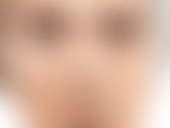 The Price of Youth What to Expect from Facelift Surgery in Dubai